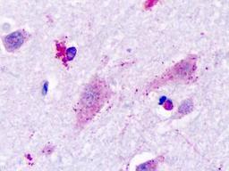 Immunohistochemistry-Paraffin: Histamine H3 R Antibody [NLS3262] - Analysis of anti-Histamine 3 Receptor / HRH3 antibody with human brain, neurons.