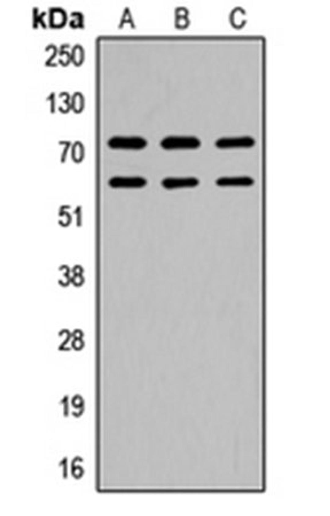 Western blot analysis of Raji (Lane 1), mouse brain (Lane 2), rat brain (Lane 3) whole cell lysates using CaMK2 beta/gamma (phospho-T287) antibody