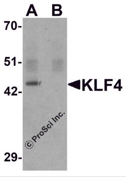 Western blot analysis of KLF4 in mouse liver tissue lysate with KLF4 antibody at 1 &#956;g/mL in (A) the absence and (B) the presence of blocking peptide.