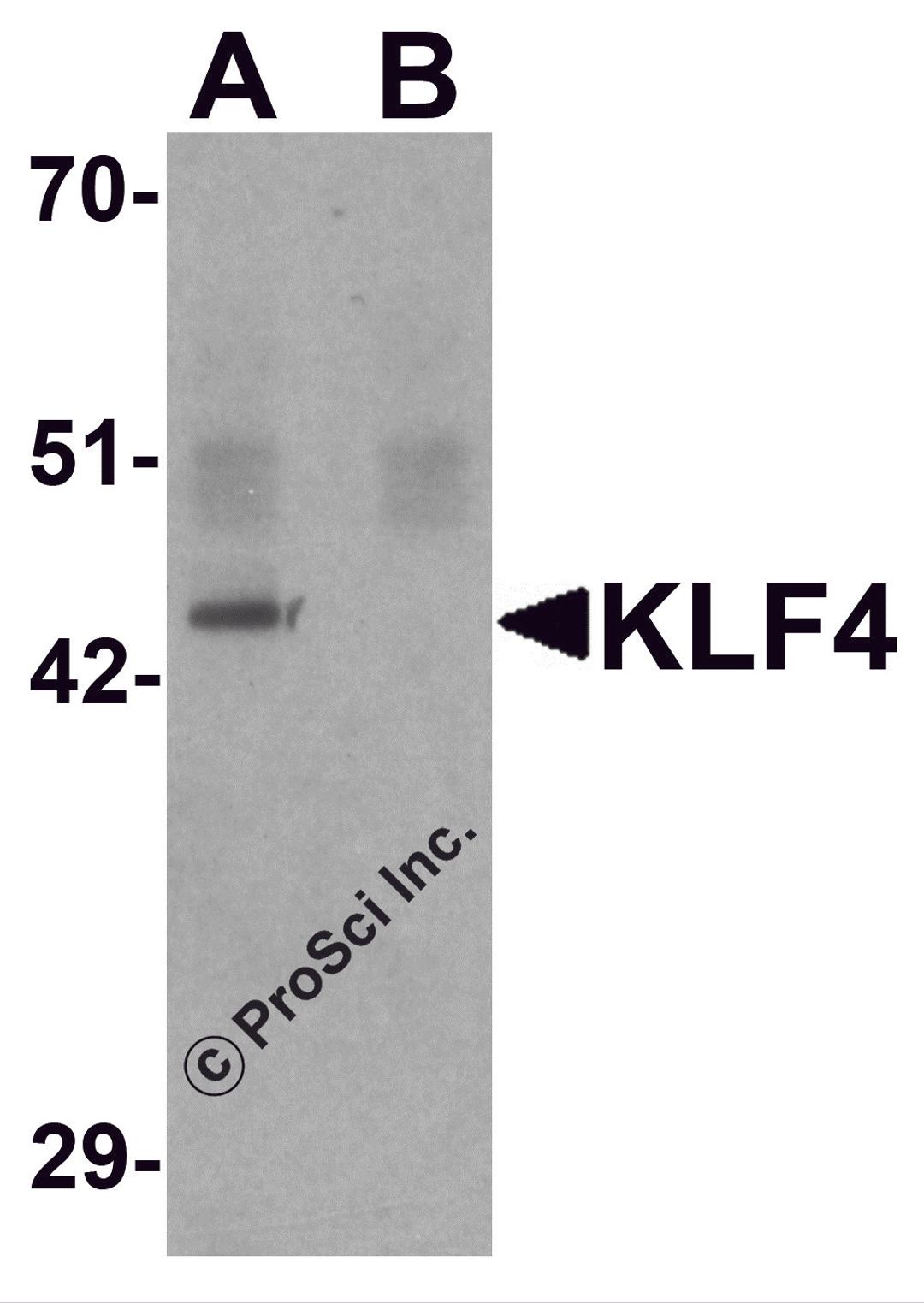 Western blot analysis of KLF4 in mouse liver tissue lysate with KLF4 antibody at 1 μg/mL in (A) the absence and (B) the presence of blocking peptide.