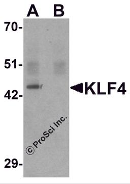 Western blot analysis of KLF4 in mouse liver tissue lysate with KLF4 antibody at 1 μg/mL in (A) the absence and (B) the presence of blocking peptide.