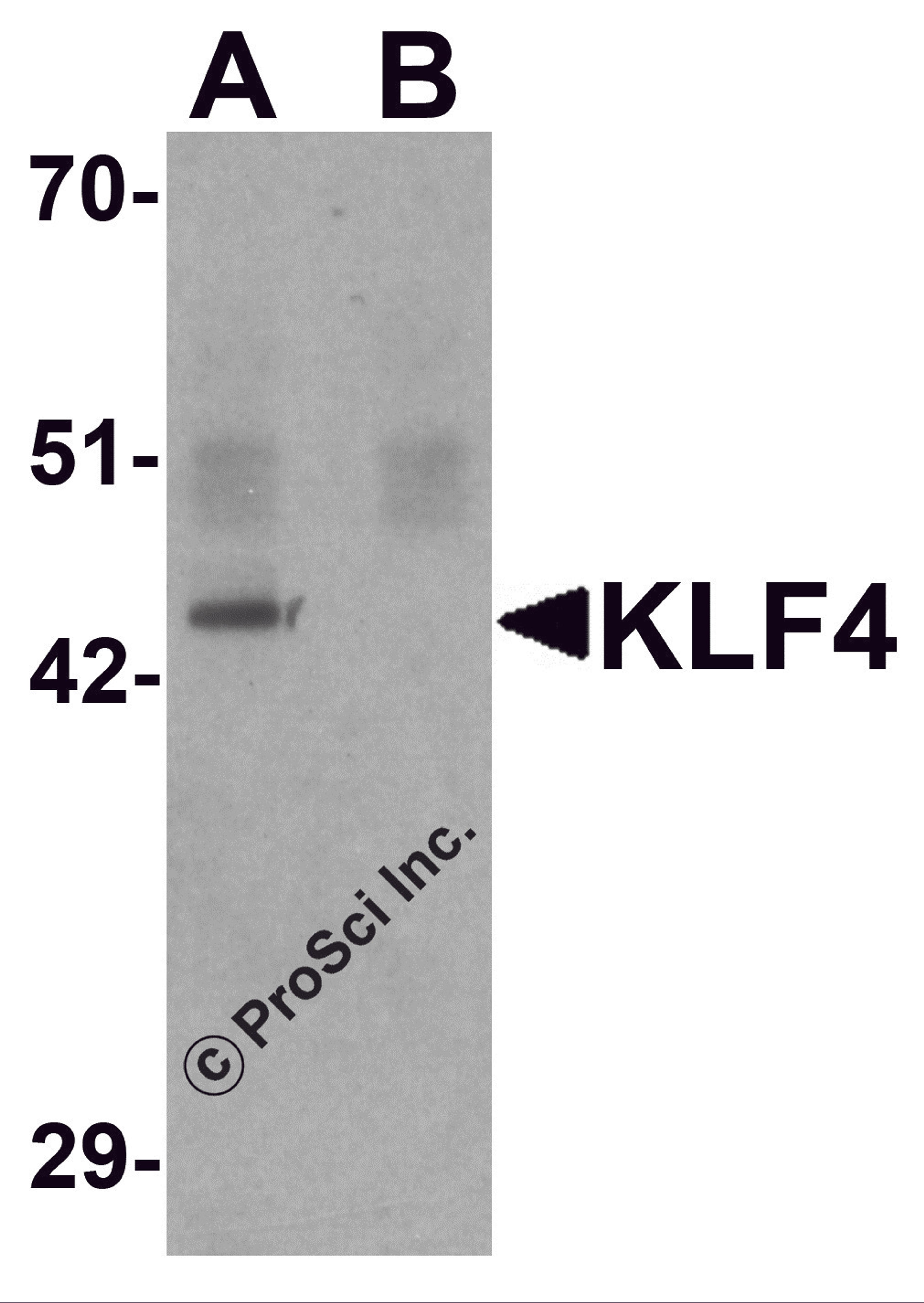 Western blot analysis of KLF4 in mouse liver tissue lysate with KLF4 antibody at 1 μg/mL in (A) the absence and (B) the presence of blocking peptide.