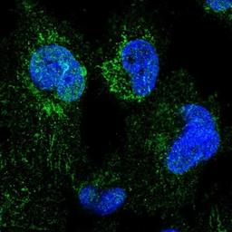 Immunocytochemistry/Immunofluorescence: NDUFB4 Antibody [NBP2-33626] - Immunofluorescent staining of human cell line U-251 MG shows positivity in nucleus but not nucleoli, nuclear membrane & mitochondria.