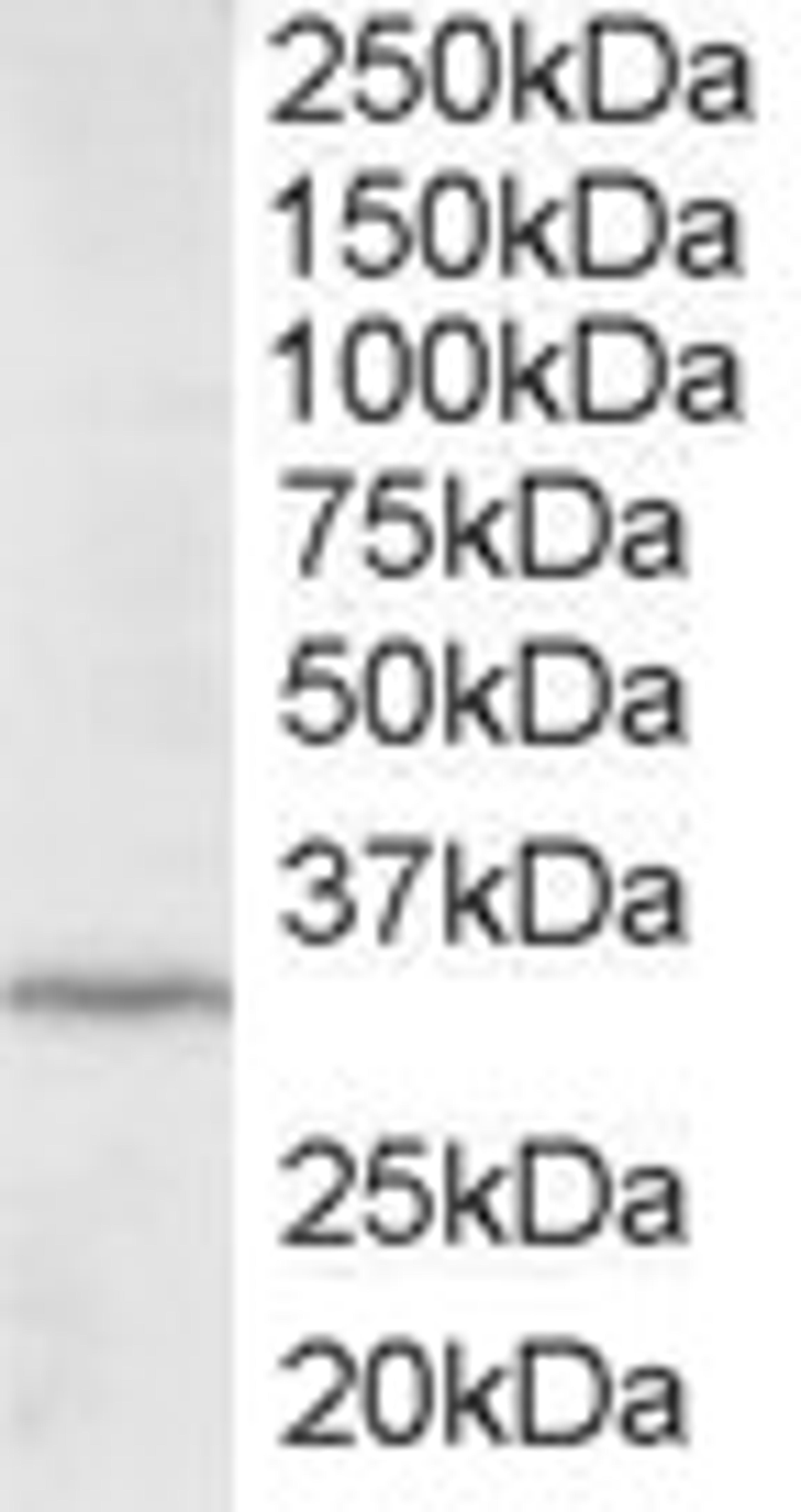 45-774 staining (2ug/ml) of HepG2 lysate (RIPA buffer, 35ug total protein per lane). Primary incubated for 12 hour. Detected by chemiluminescence.