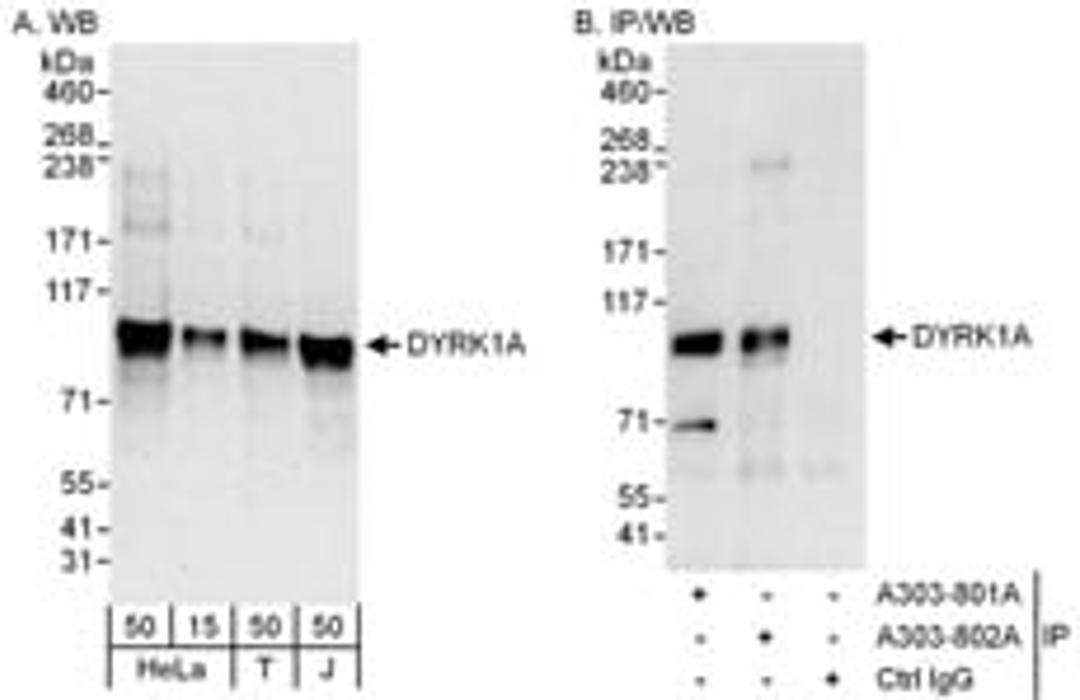 Detection of human DYRK1A by western blot and immunoprecipitation.