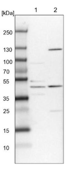 Western Blot: C11orf84 Antibody [NBP1-81298] - Lane 1: NIH-3T3 cell lysate (Mouse embryonic fibroblast cells)<br/>Lane 2: NBT-II cell lysate (Rat Wistar bladder tumour cells)