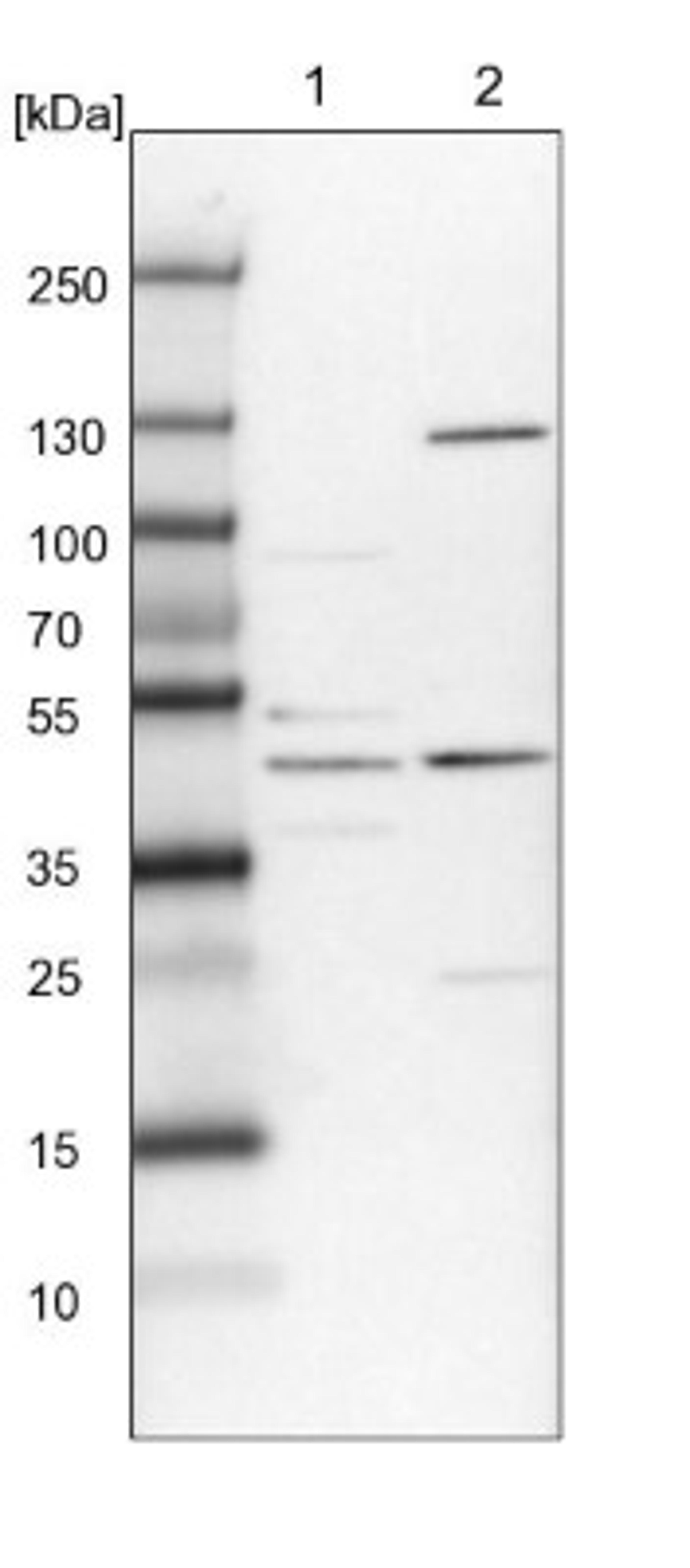 Western Blot: C11orf84 Antibody [NBP1-81298] - Lane 1: NIH-3T3 cell lysate (Mouse embryonic fibroblast cells)<br/>Lane 2: NBT-II cell lysate (Rat Wistar bladder tumour cells)