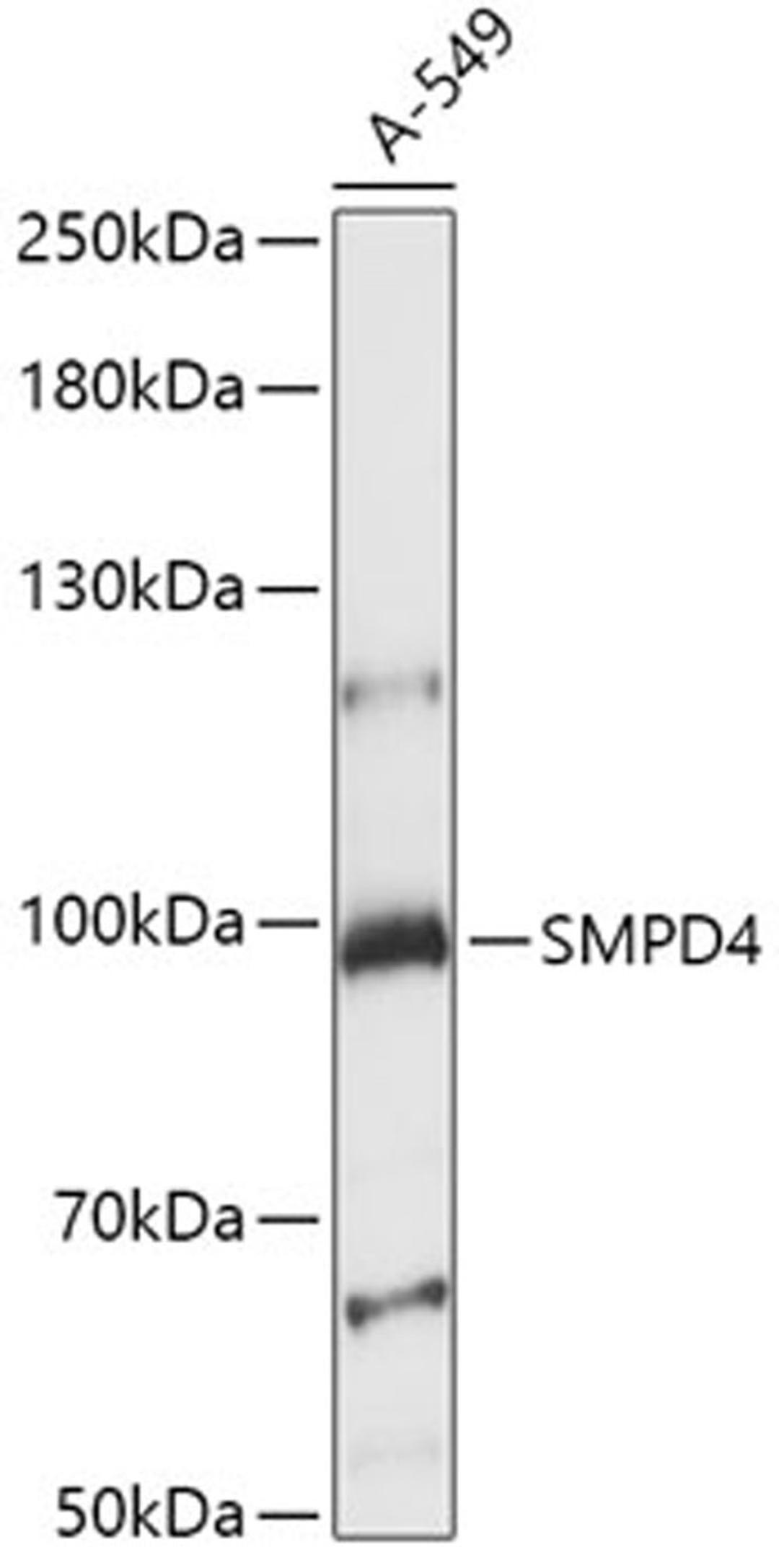 Western blot - SMPD4 antibody (A15473)