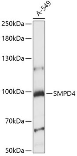 Western blot - SMPD4 antibody (A15473)