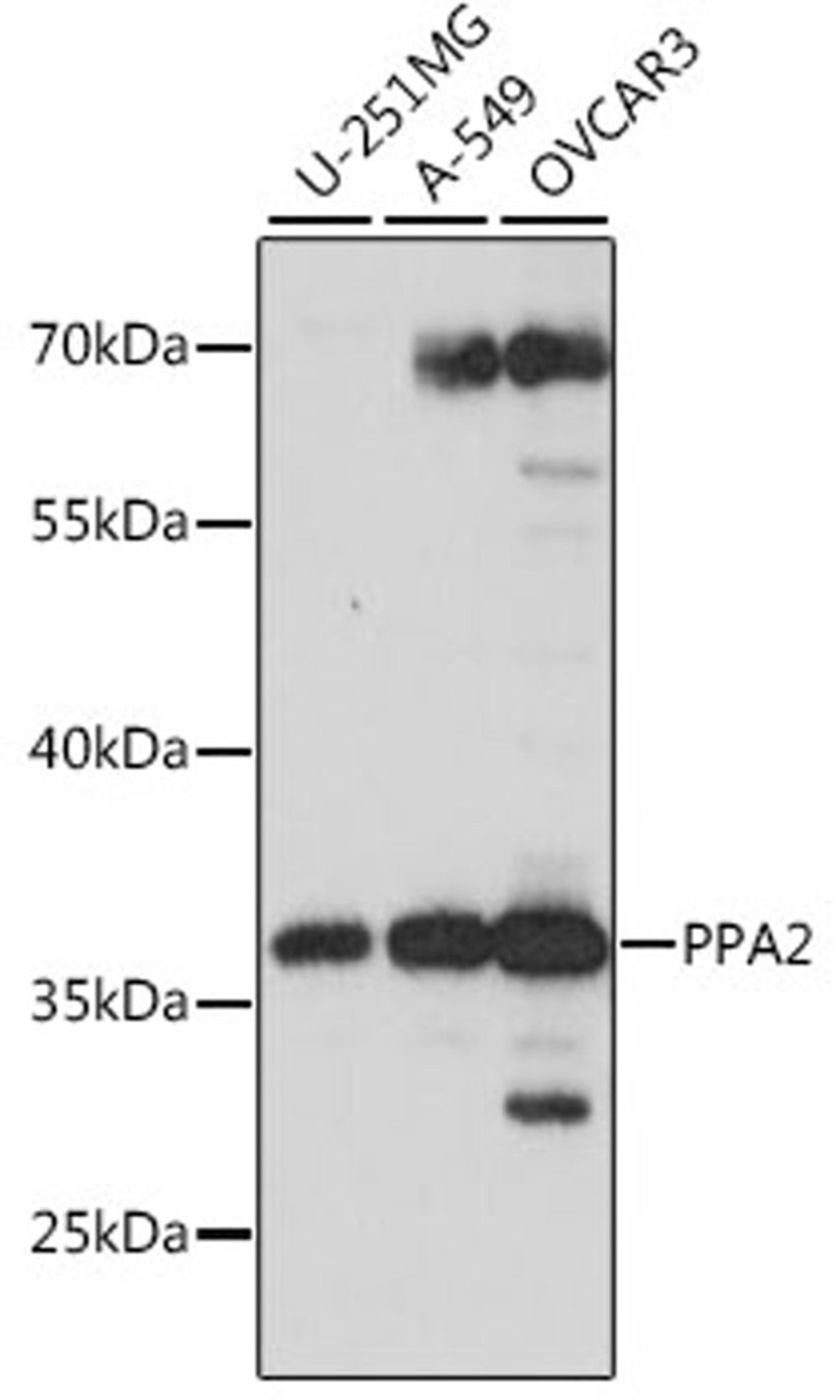 Western blot - PPA2 antibody (A15819)