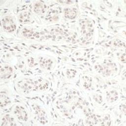 Detection of human CHD8 by immunohistochemistry.