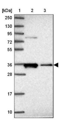 Western Blot: Cyclin D2 Antibody [NBP2-14460] - Lane 1: Marker [kDa] 250, 130, 95, 72, 55, 36, 28, 17, 10<br/>Lane 2: Human cell line RT-4<br/>Lane 3: Human cell line U-251MG sp