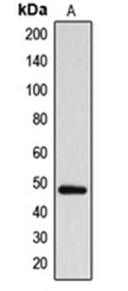 Western blot analysis of MDAMB231 (Lane 1) whole cell lysates using ARRDC1 antibody