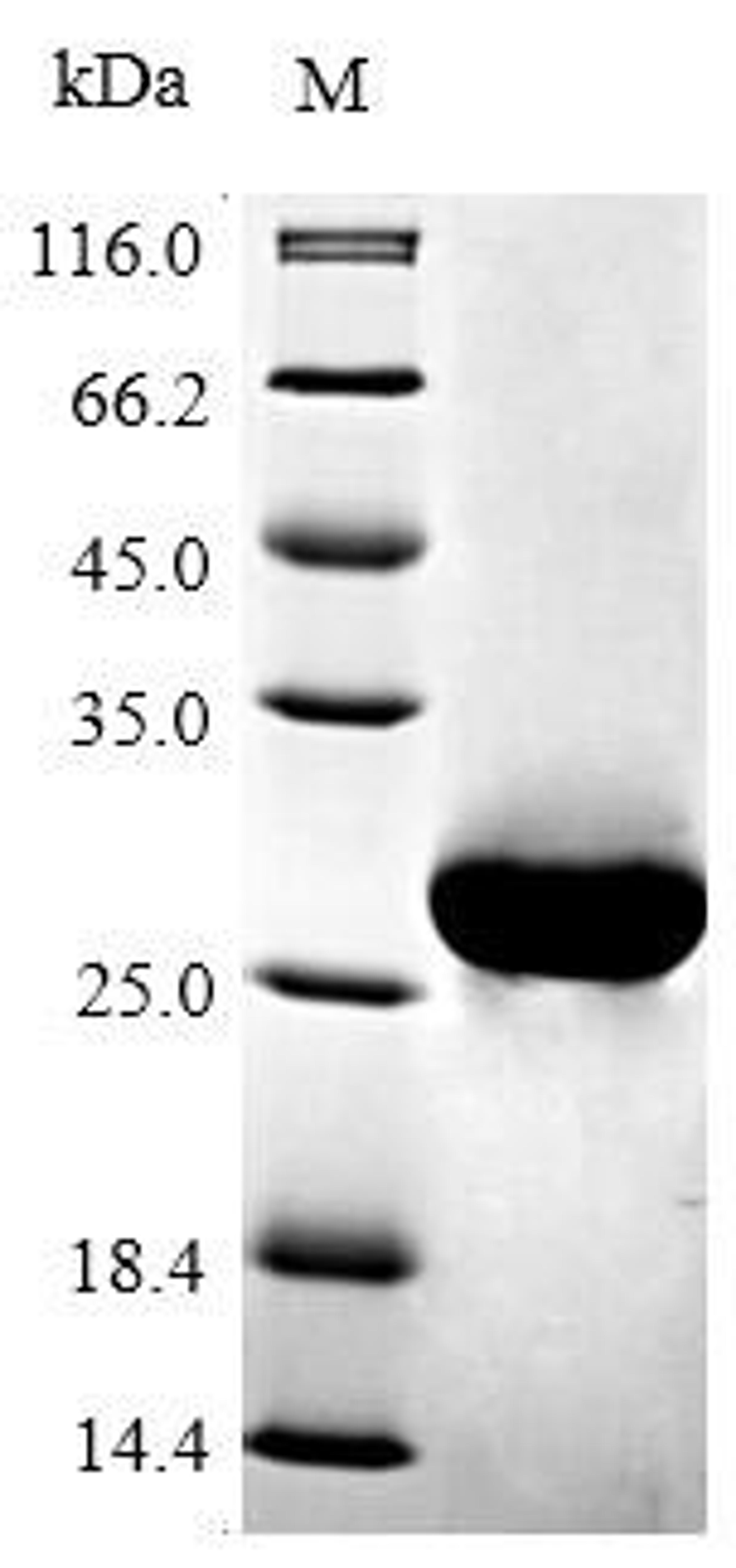 (Tris-Glycine gel) Discontinuous SDS-PAGE (reduced) with 5% enrichment gel and 15% separation gel.