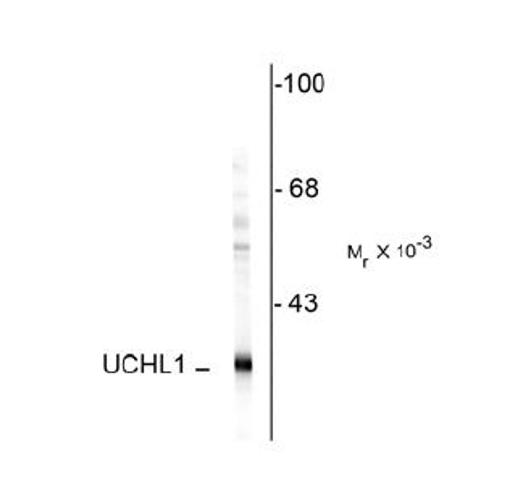 Western blot of rat cerebellar lysate showing specific immunolabeling of the ~ 57k peripherin protein.