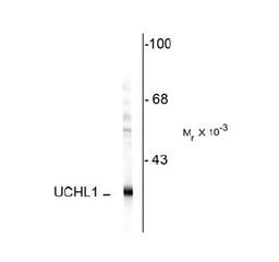 Western blot of rat cerebellar lysate showing specific immunolabeling of the ~ 57k peripherin protein.