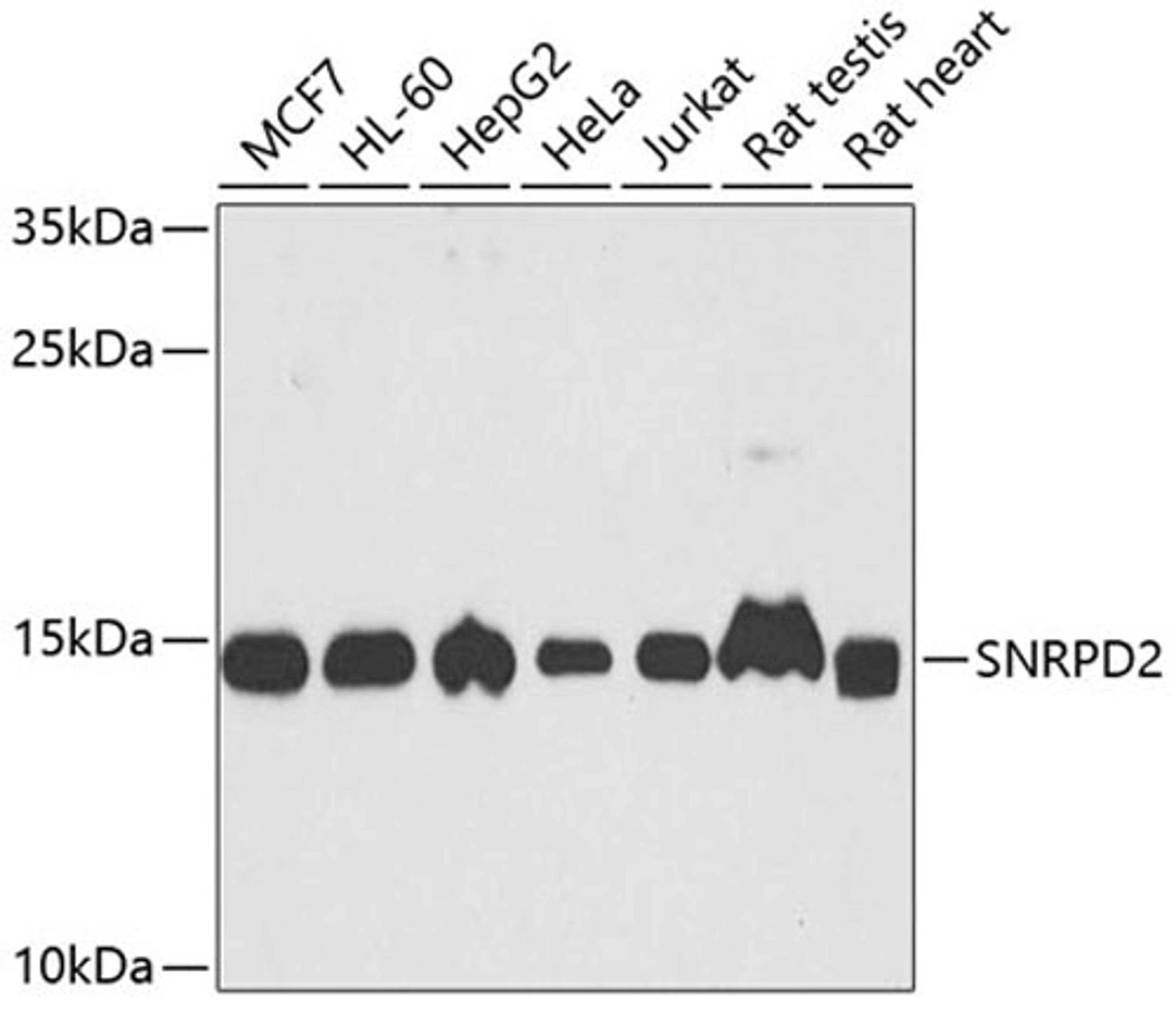 Western blot - SNRPD2 antibody (A6983)