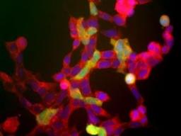 Immunocytochemistry/Immunofluorescence: Enolase 2/Neuron-specific Enolase Antibody [NB110-58870] - Shows the human embryonic kidney cells line 293, which express many neuronal proteins (1). The red channel shows staining which recognizes all of these 293 cells. The green channels shows staining for another neuronal marker to UCHL1 using NB110-58869. This neuronal gene is apparently activated in a cell density dependent fashion and at this stage only a few cells express this protein. However all cells that express NSE also express UCHL1.