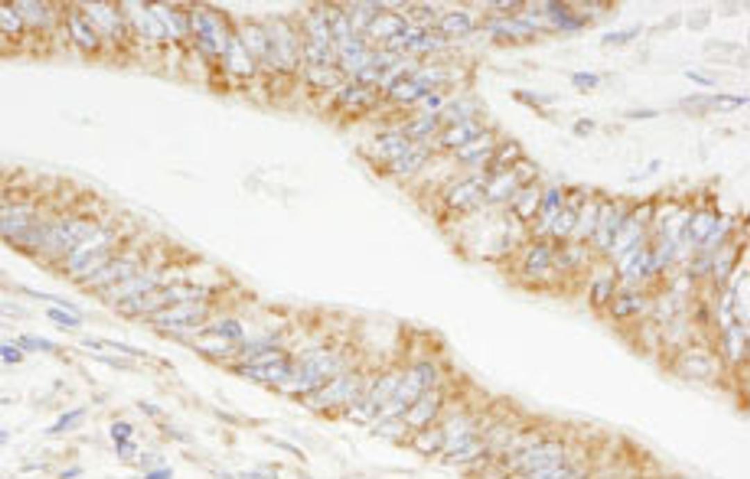 Detection of human TRIM3/BERP by immunohistochemistry.