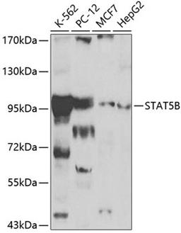 Western blot - STAT5B antibody (A0275)