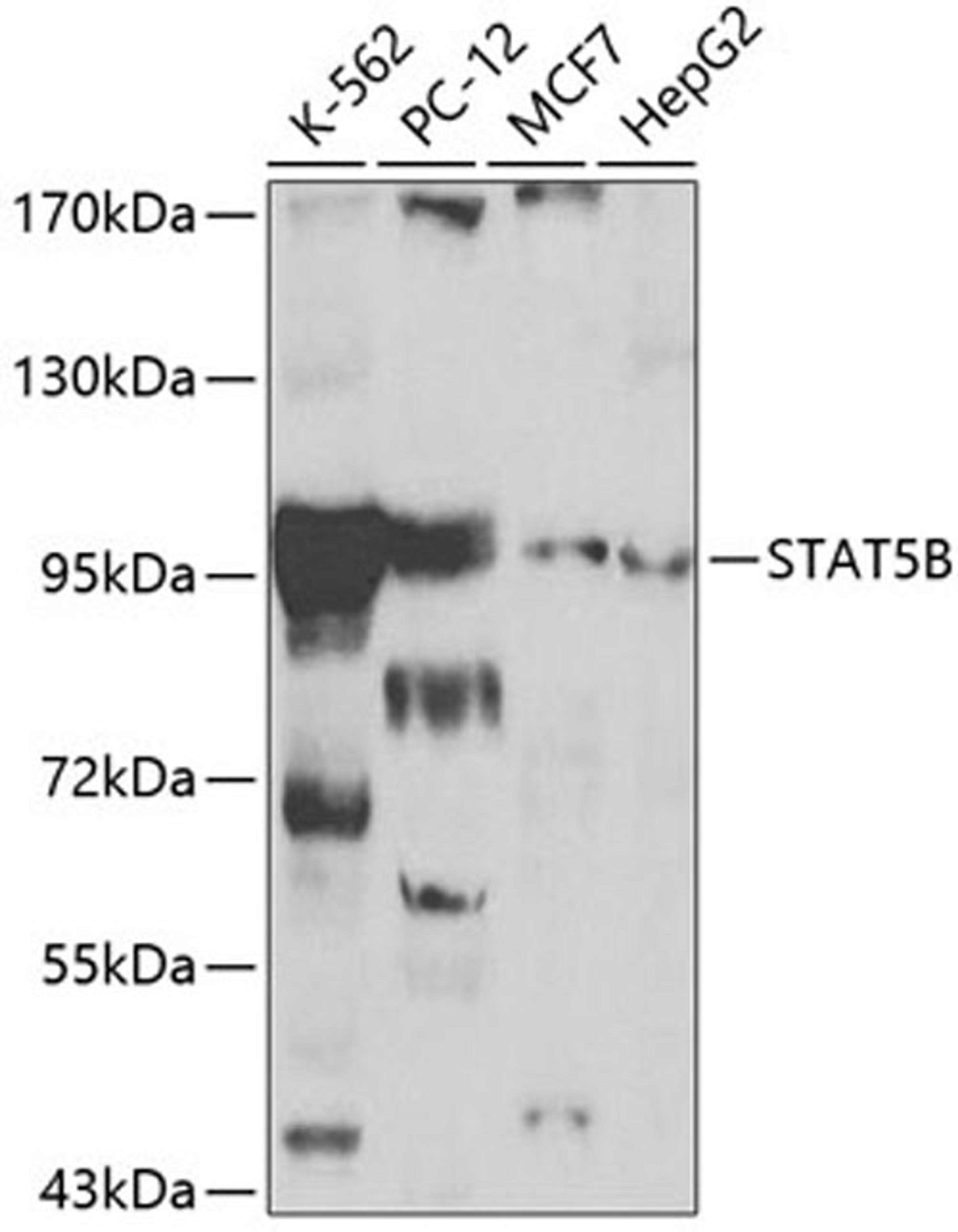 Western blot - STAT5B antibody (A0275)