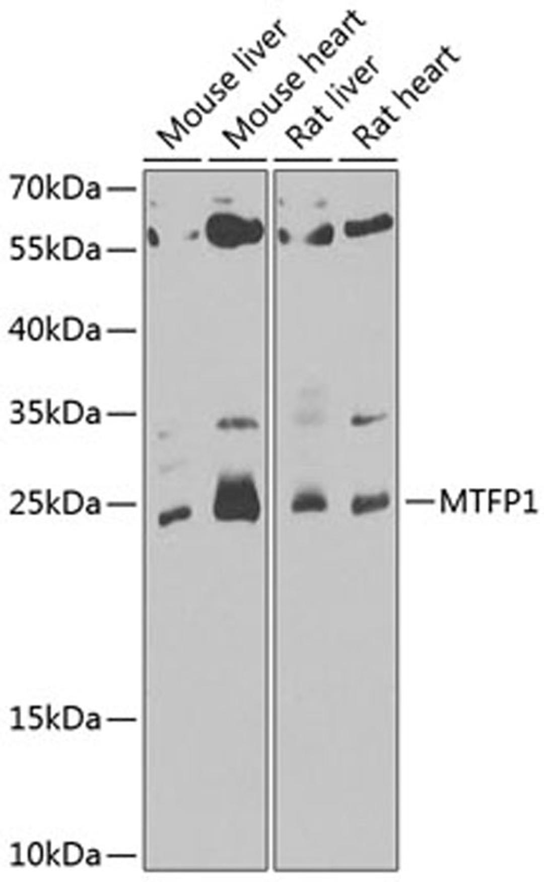 Western blot - MTFP1 antibody (A7110)