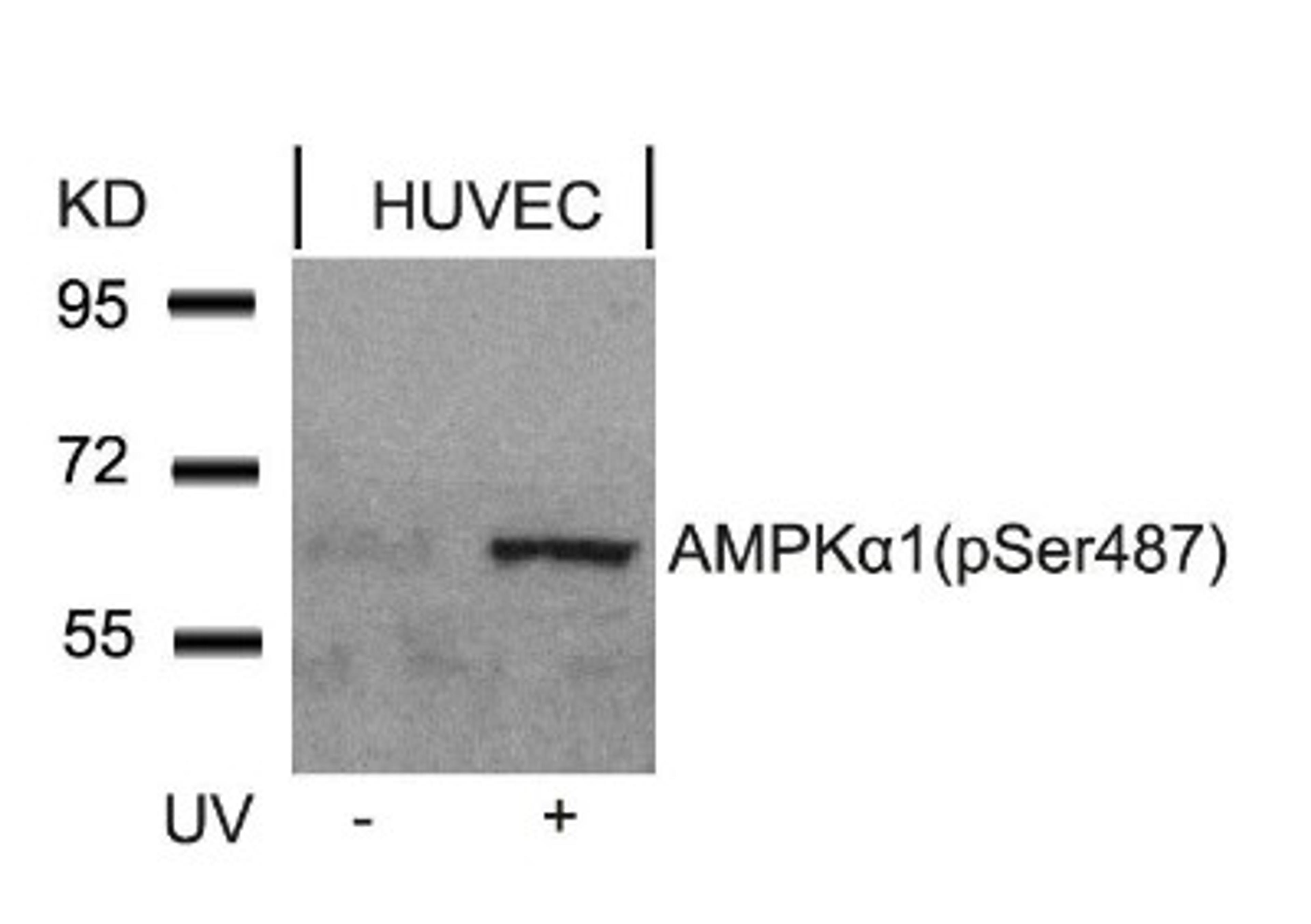 Western Blot: AMPK alpha 1 [p Ser487] Antibody [NB100-81784] - Analysis of extracts from HUVEC cells untreated or treated with UV using AMPK alpha 1(Phospho-Ser487)Antibody