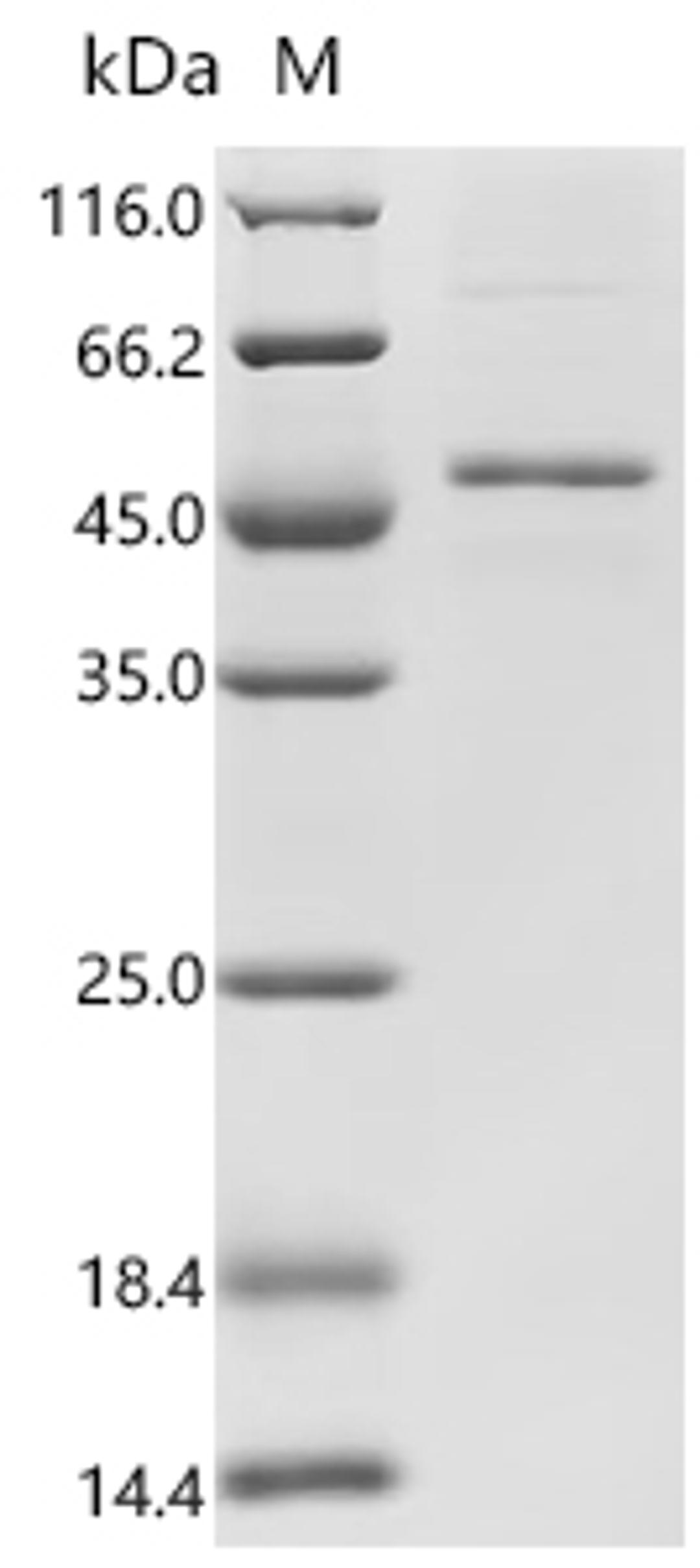(Tris-Glycine gel) Discontinuous SDS-PAGE (reduced) with 5% enrichment gel and 15% separation gel.