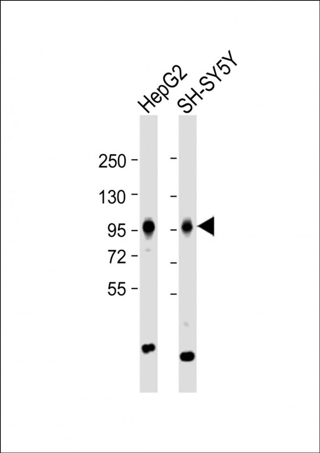 Western Blot at 1:1000 dilution Lane 1: HepG2 whole cell lysate Lane 2: SH-SY5Y whole cell lysate Lysates/proteins at 20 ug per lane.