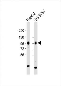 Western Blot at 1:1000 dilution Lane 1: HepG2 whole cell lysate Lane 2: SH-SY5Y whole cell lysate Lysates/proteins at 20 ug per lane.