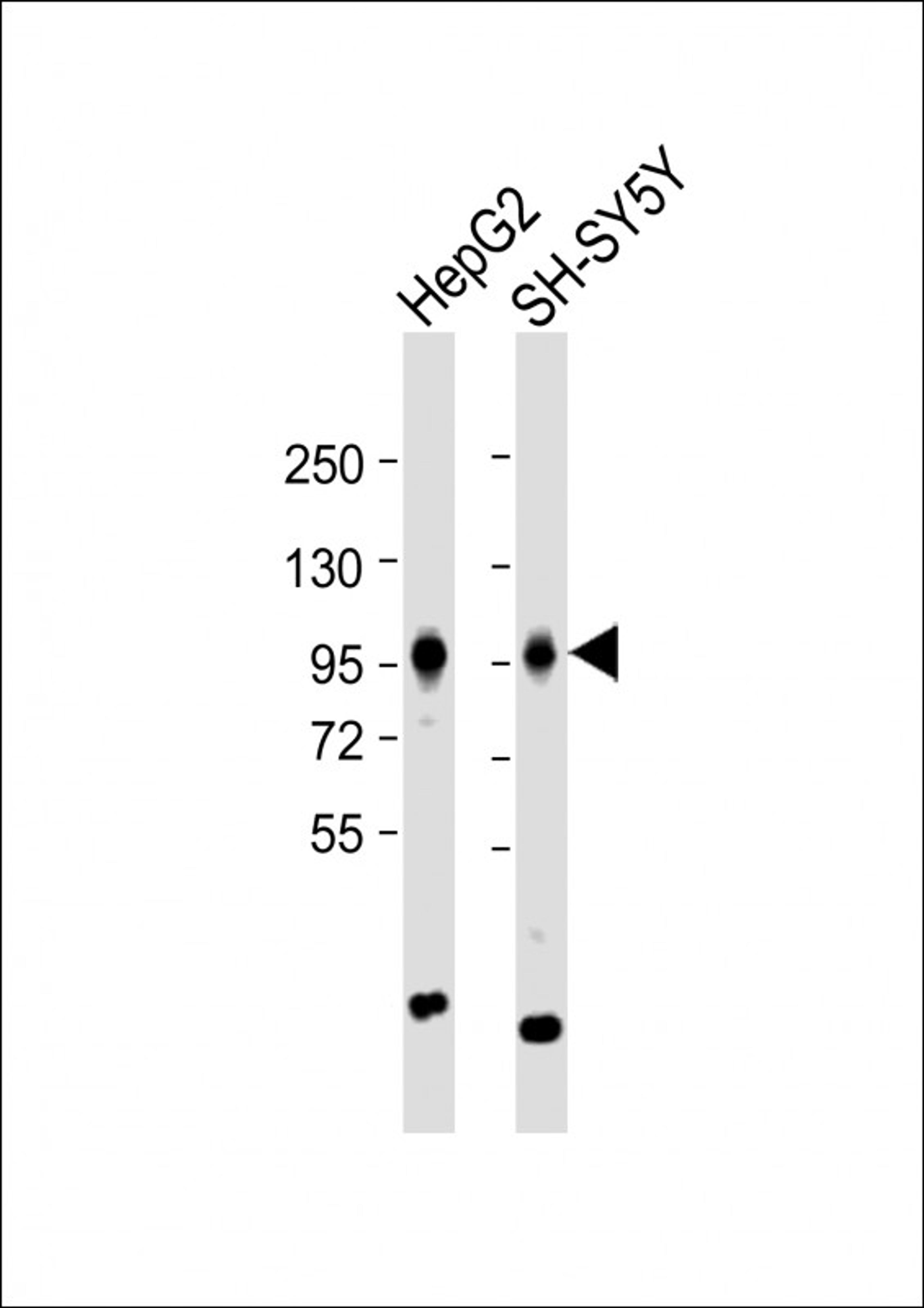 Western Blot at 1:1000 dilution Lane 1: HepG2 whole cell lysate Lane 2: SH-SY5Y whole cell lysate Lysates/proteins at 20 ug per lane.