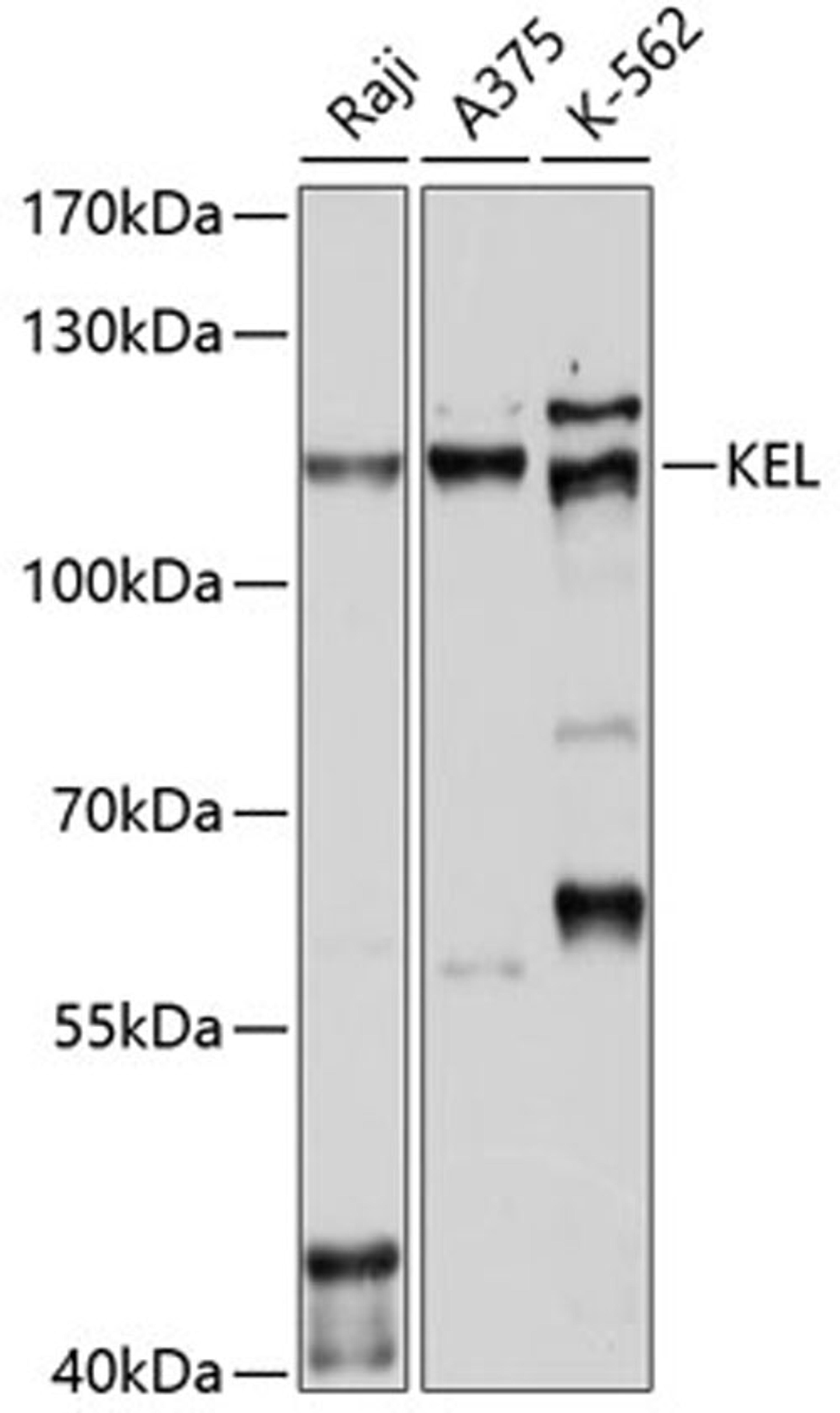 Western blot - KEL antibody (A10116)