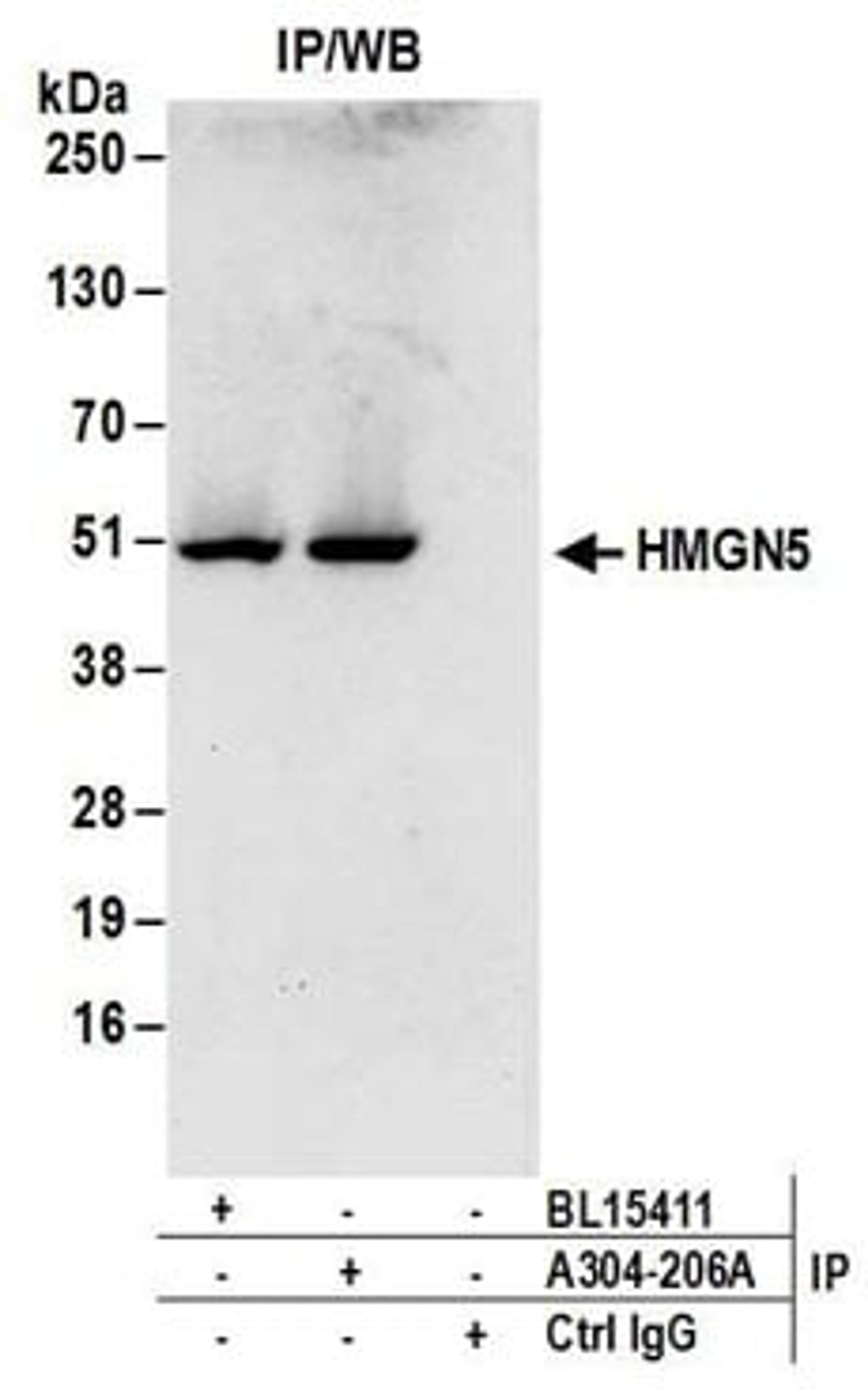 Detection of human HMGN5 by western blot of immunoprecipitates.