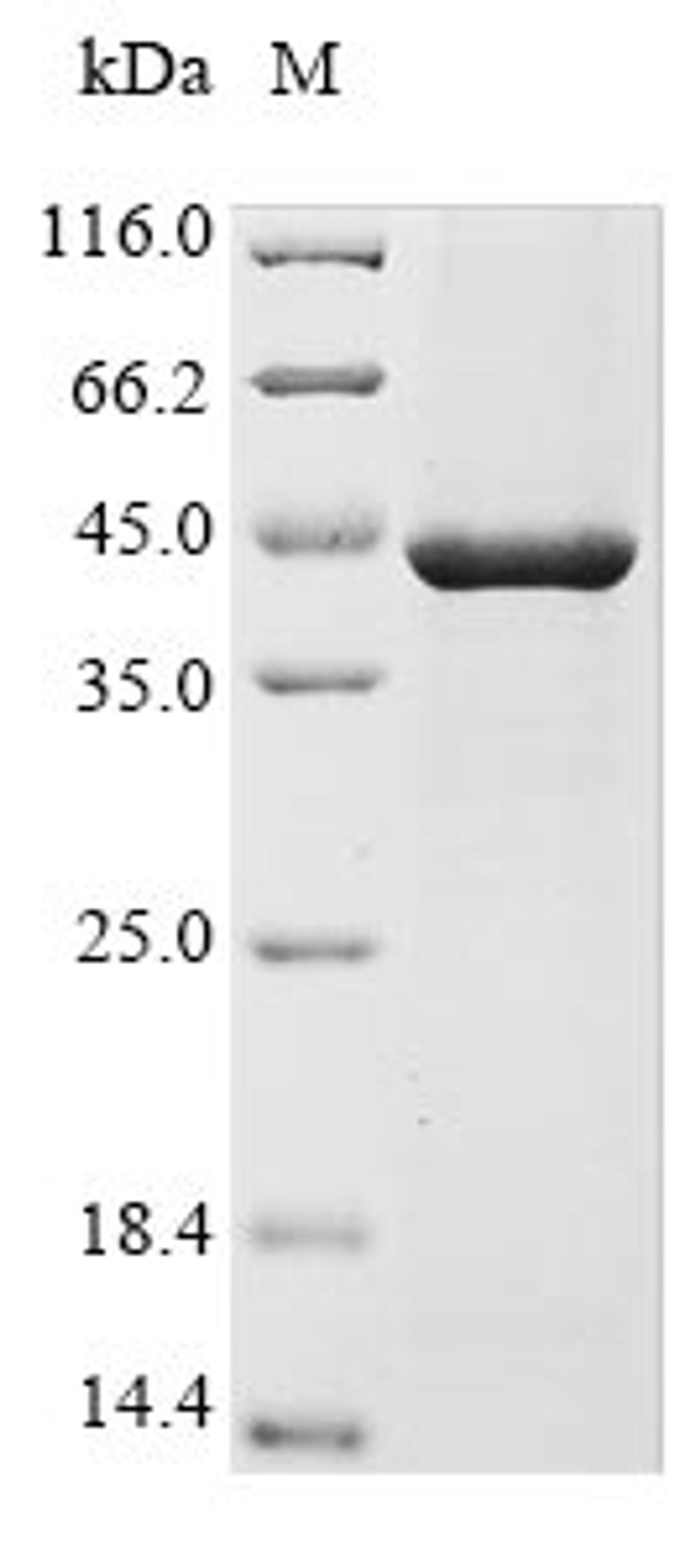 (Tris-Glycine gel) Discontinuous SDS-PAGE (reduced) with 5% enrichment gel and 15% separation gel.