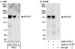 Detection of human MTUS1 by western blot and immunoprecipitation.