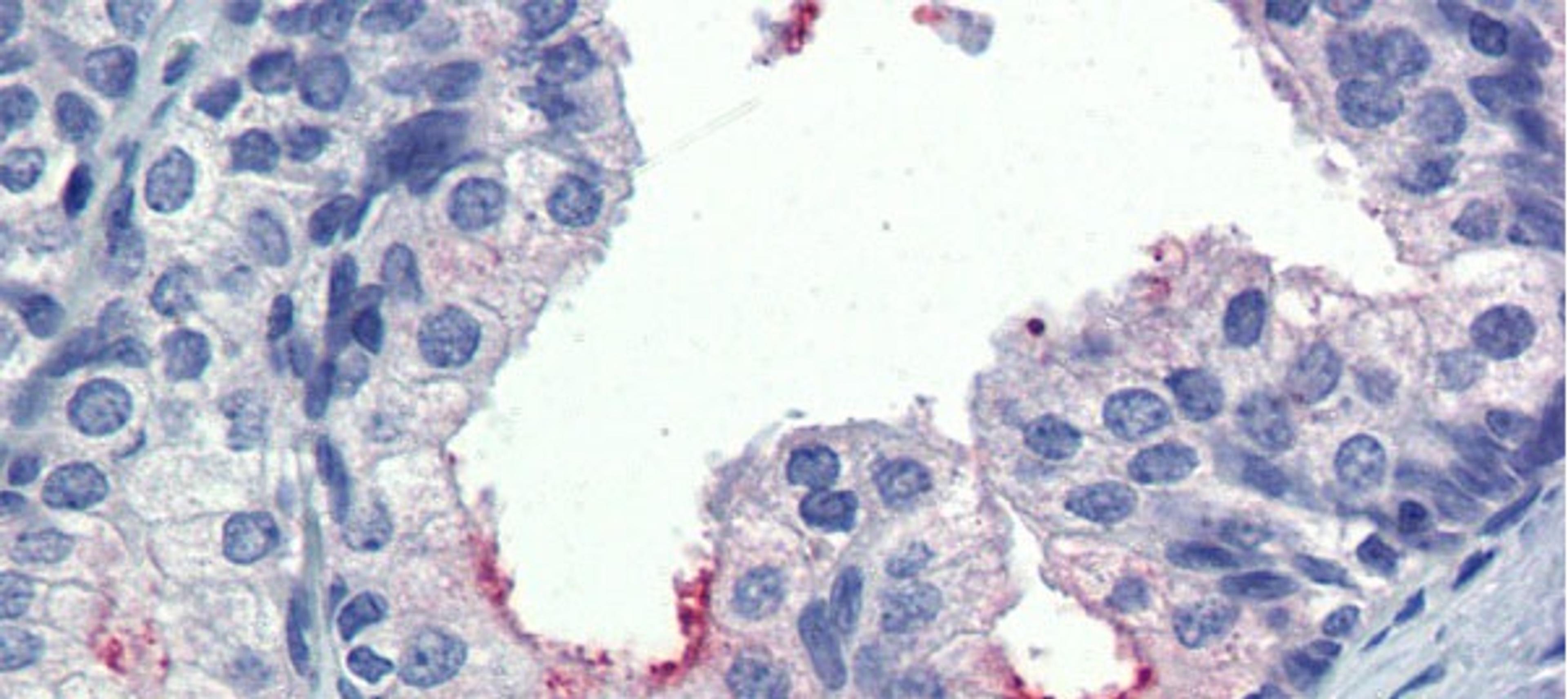 Antibody used in IHC on Human Prostate at 5.0 ug/ml.