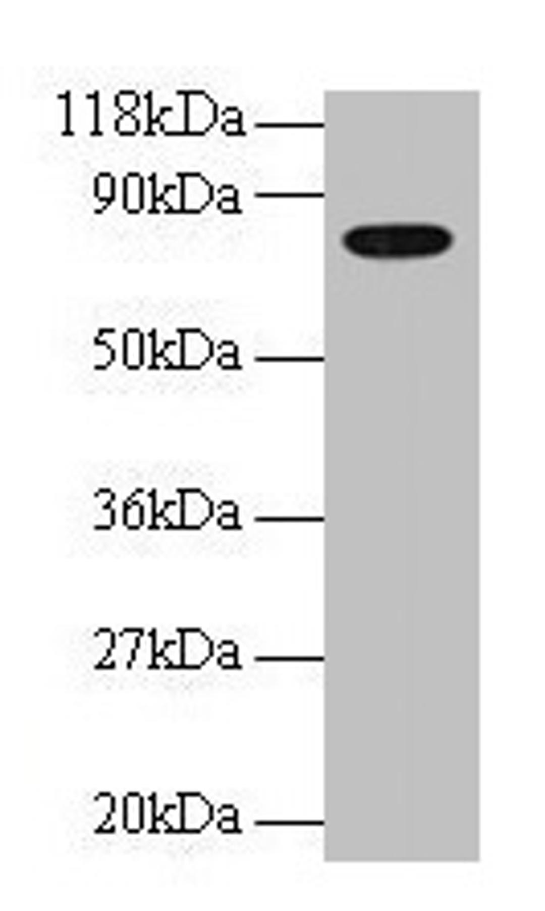 Western blot. All lanes: Human Transferrin antibody at 2µg/ml + EC109 whole cell lysate. Secondary. Goat polyclonal to rabbit IgG at 1/15000 dilution. Predicted band size: 78 kDa. Observed band size: 78 kDa