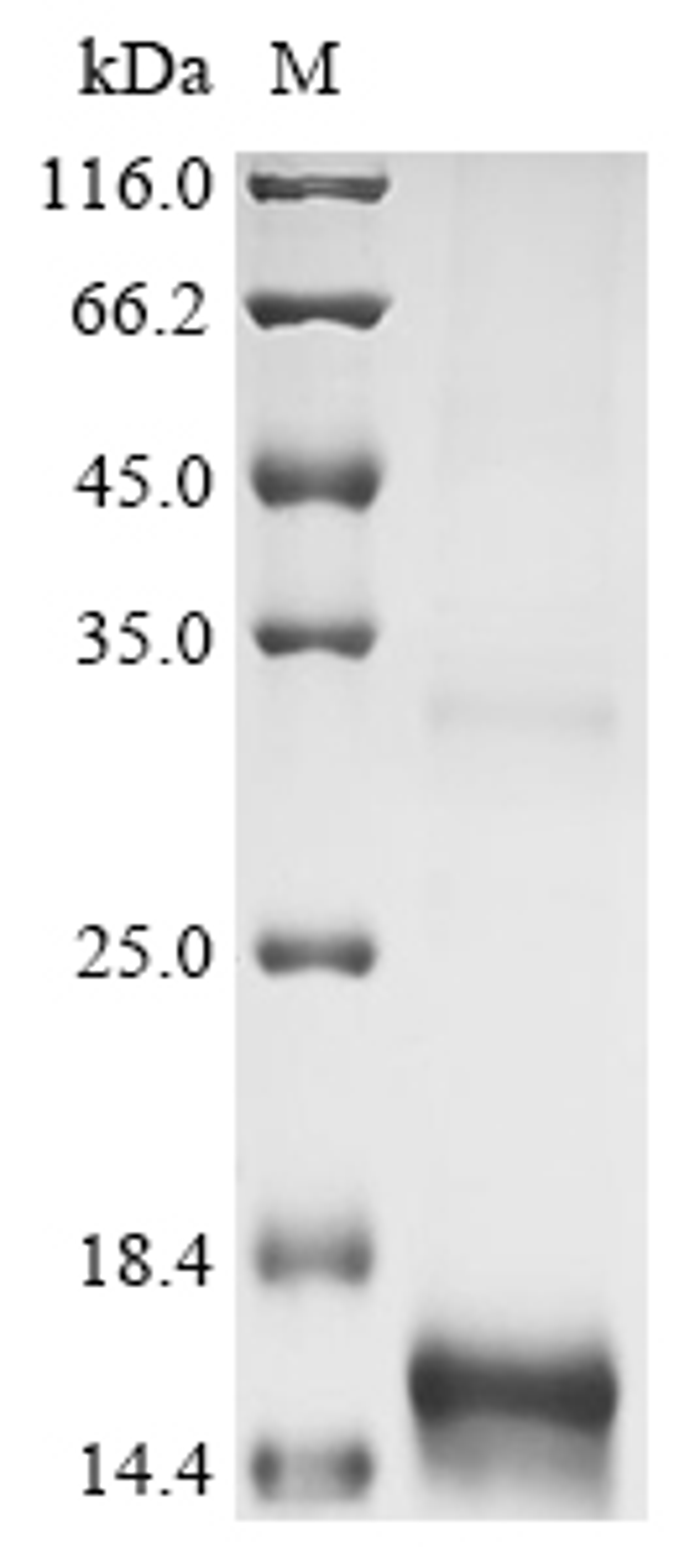 (Tris-Glycine gel) Discontinuous SDS-PAGE (reduced) with 5% enrichment gel and 15% separation gel.