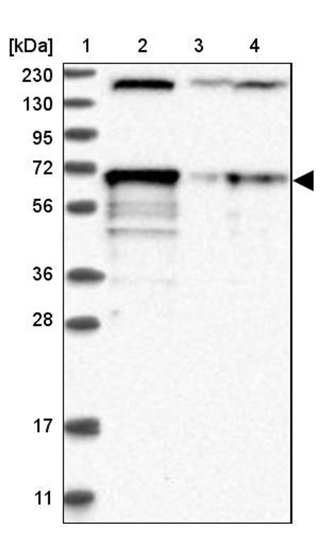 Western Blot: LTV1 Antibody [NBP1-86733] - Lane 1: Marker [kDa] 230, 130, 95, 72, 56, 36, 28, 17, 11<br/>Lane 2: Human cell line RT-4<br/>Lane 3: Human cell line U-251MG sp<br/>Lane 4: Human plasma (IgG/HSA depleted)