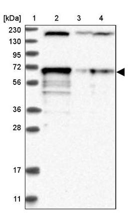 Western Blot: LTV1 Antibody [NBP1-86733] - Lane 1: Marker [kDa] 230, 130, 95, 72, 56, 36, 28, 17, 11<br/>Lane 2: Human cell line RT-4<br/>Lane 3: Human cell line U-251MG sp<br/>Lane 4: Human plasma (IgG/HSA depleted)