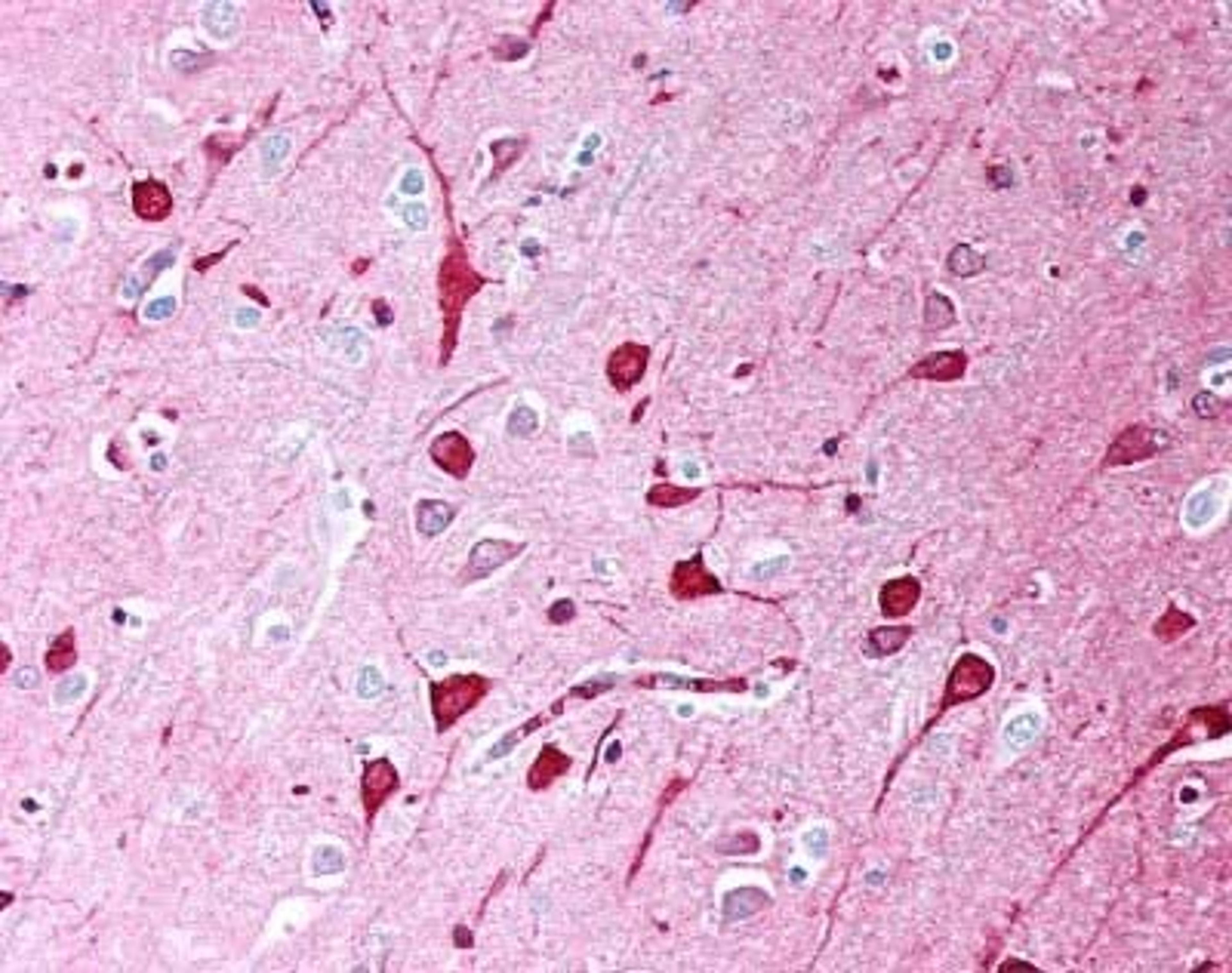 Staining of human brain showing labeling of neurons with Mouse anti Human TGF-beta (MCA797)