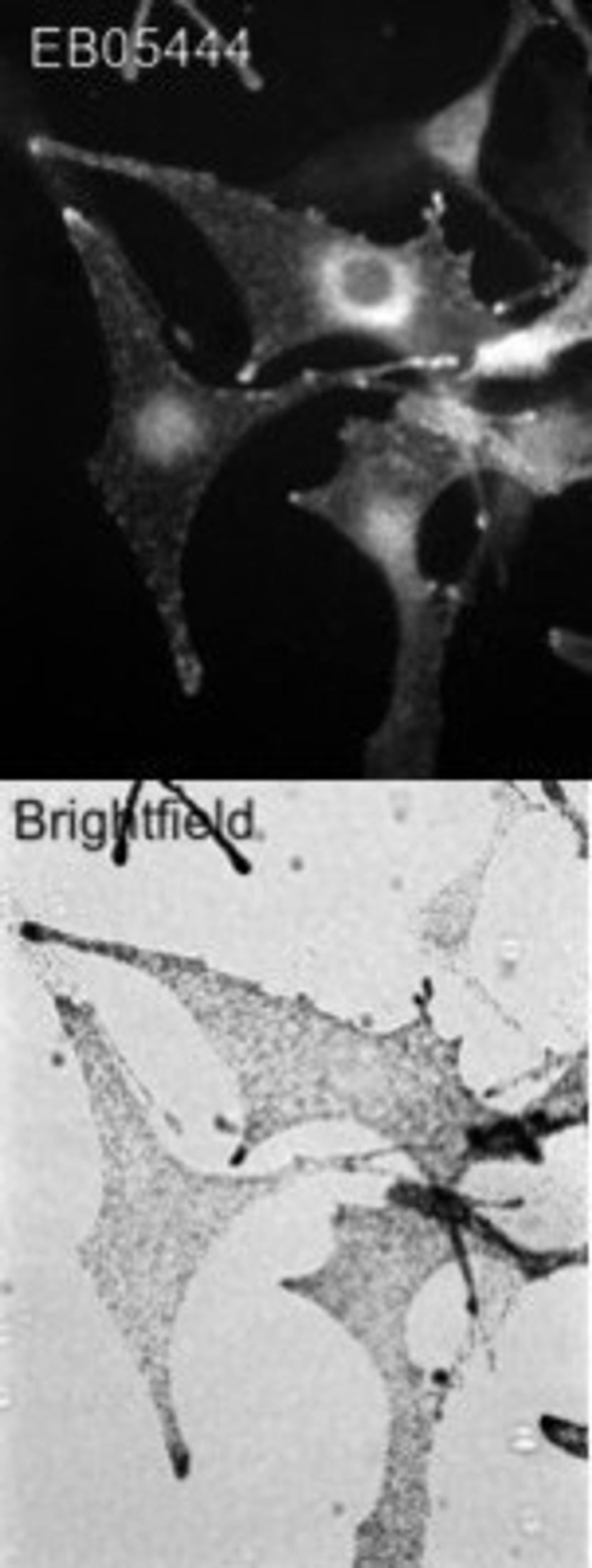 Immunohistochemistry-Paraffin: Melanophilin Antibody [NB300-943] - Wild-type C57bl6 derived melanocytes were stained with (0.5ug/ml) and detected with Alexa568 conjugated donkey anti-sheep second antibodies. Brightfield image shows melanosome distribution. Data kindly provided by A N Hume, Imperial College.