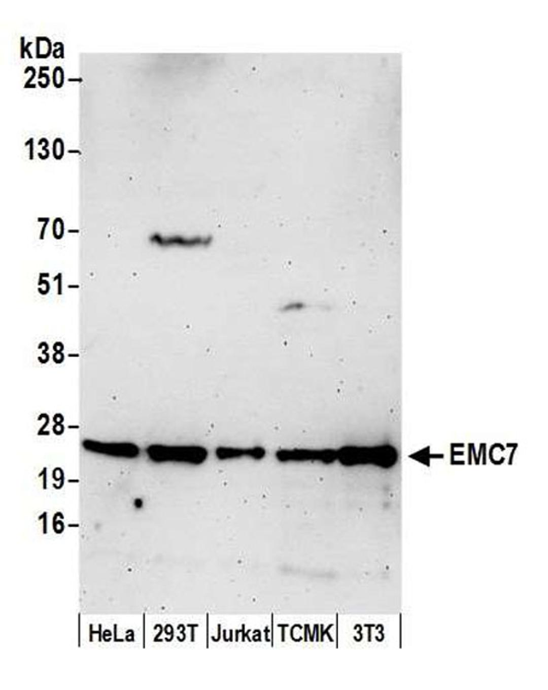 Detection of human and mouse EMC7 by WB.