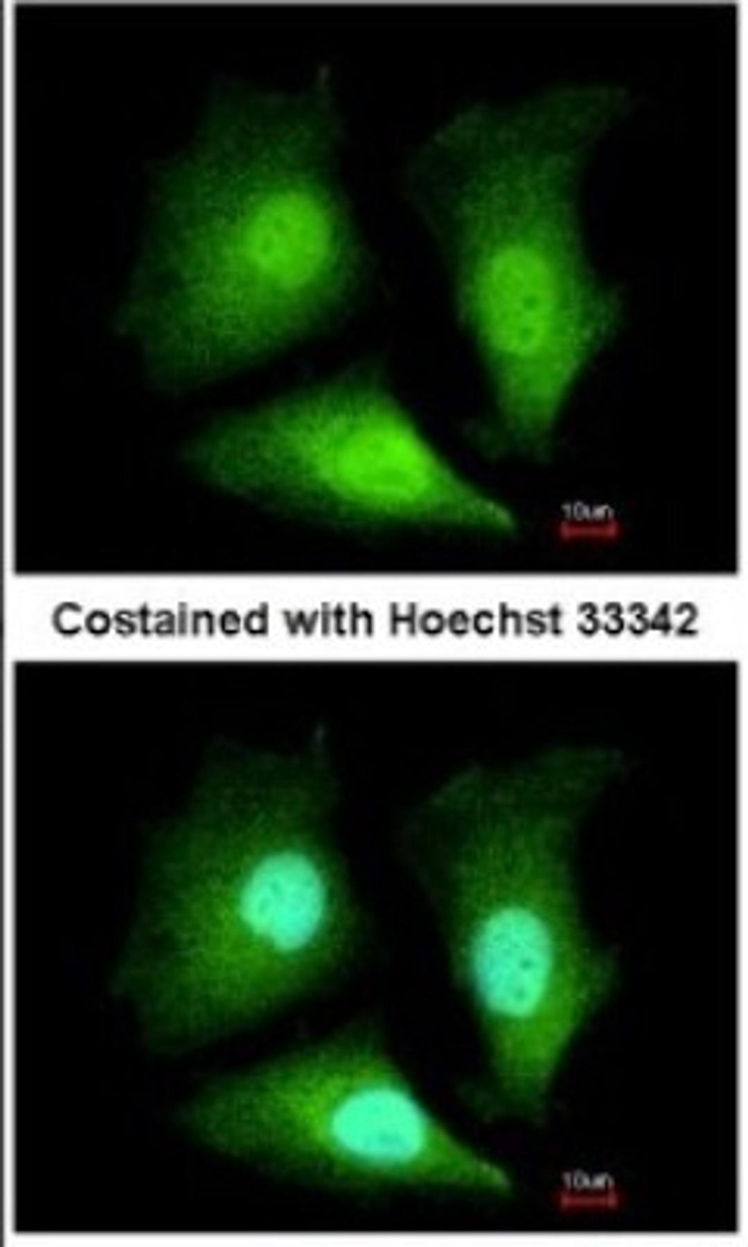 Immunocytochemistry/Immunofluorescence: ADI1 Antibody [NBP2-15299] - Paraformaldehyde-fixed HeLa, using antibody at 1:200 dilution.