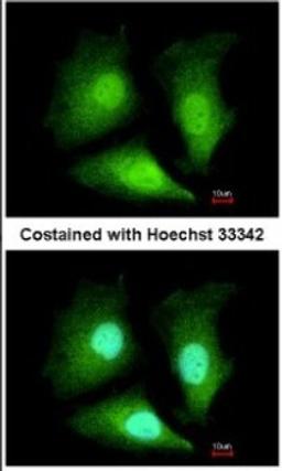 Immunocytochemistry/Immunofluorescence: ADI1 Antibody [NBP2-15299] - Paraformaldehyde-fixed HeLa, using antibody at 1:200 dilution.