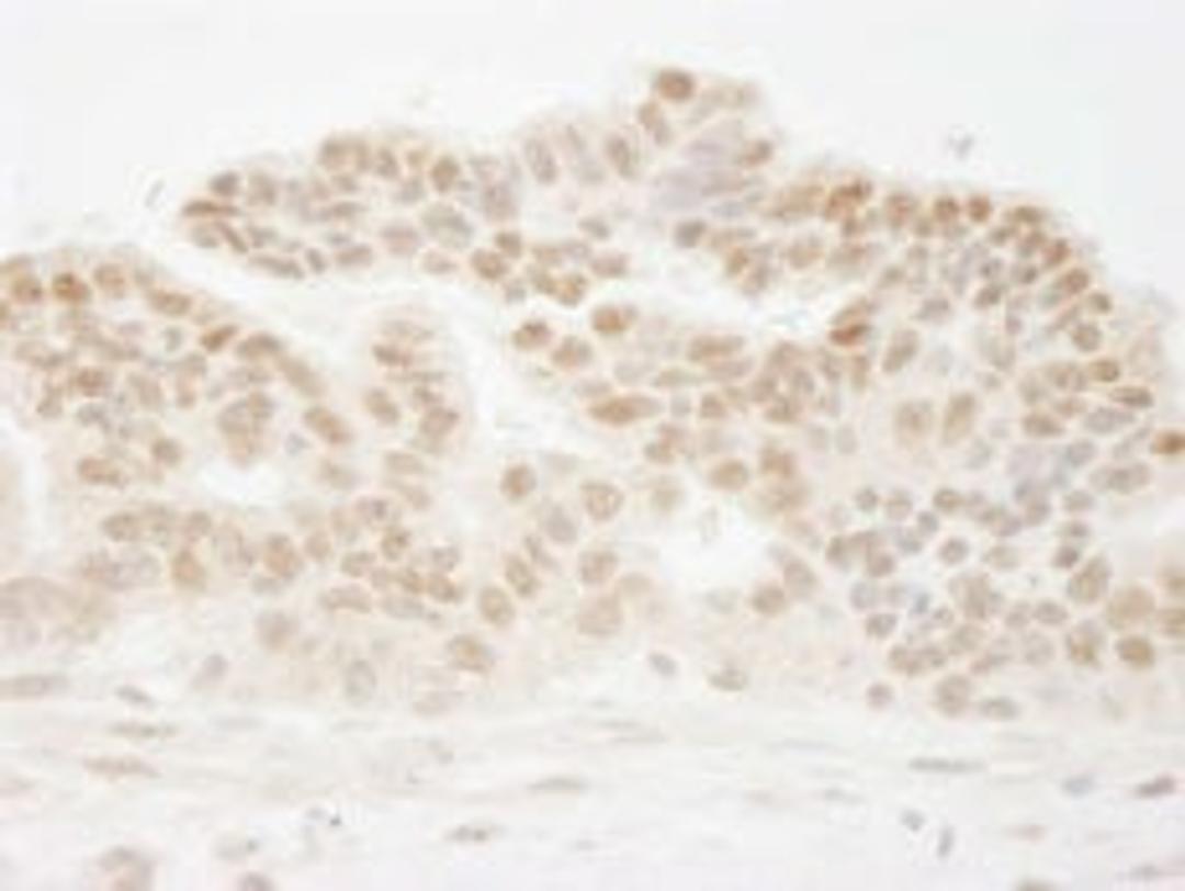 Detection of human CSTF50 by immunohistochemistry.