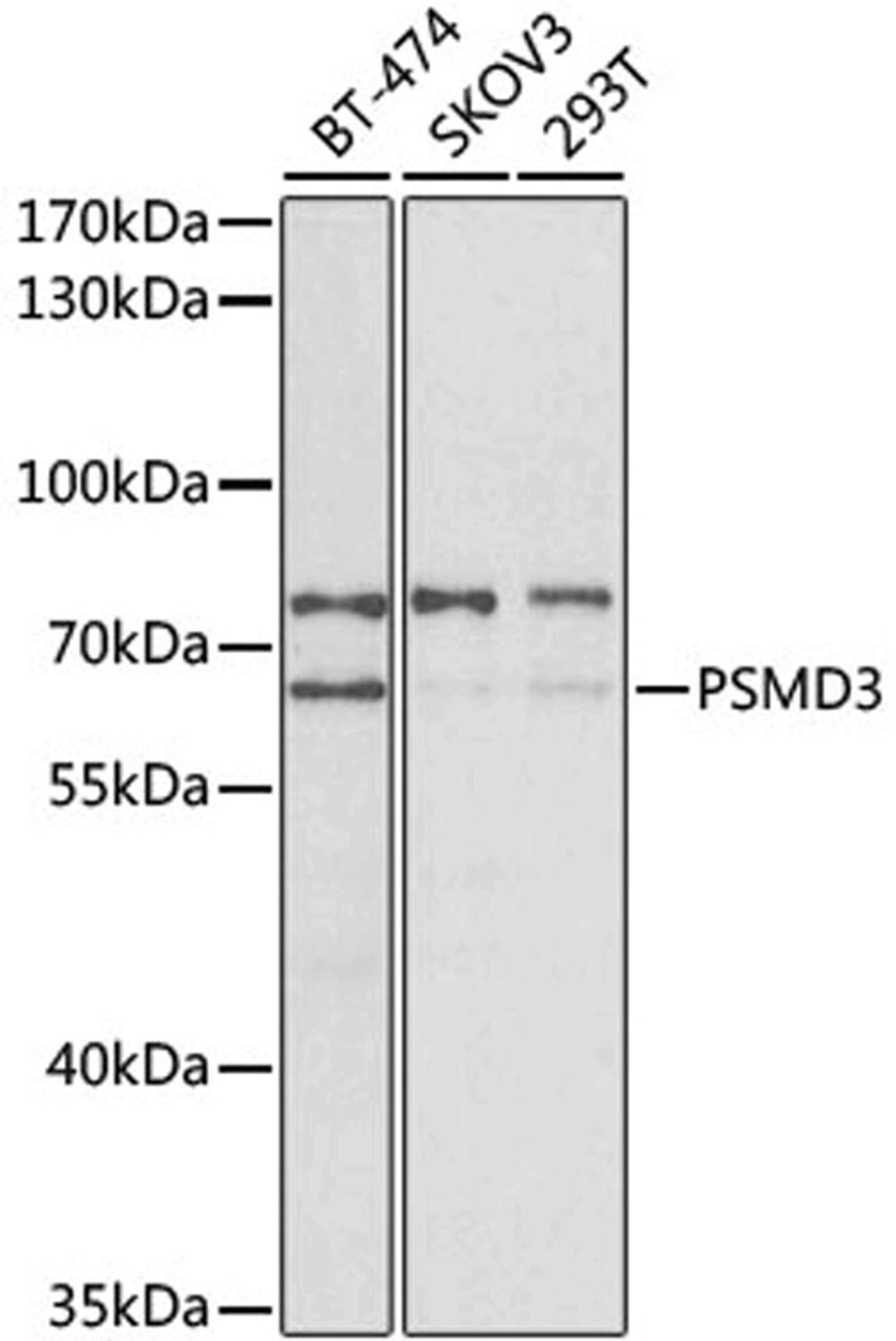 Western blot - PSMD3 antibody (A2790)