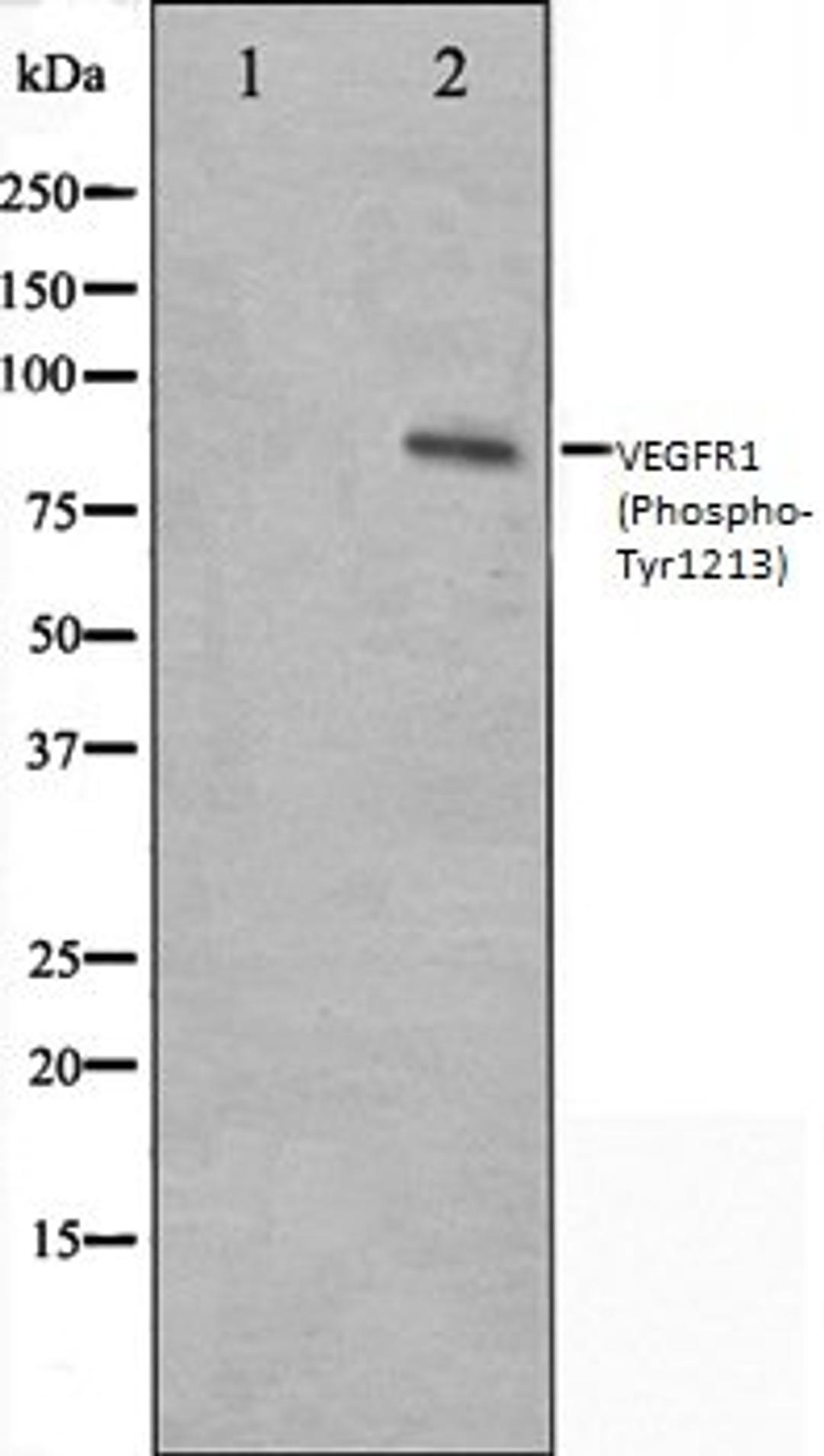 Western blot analysis of HeLa whole cell lysates using VEGFR1 (Phospho-Tyr1213) antibody, The lane on the left is treated with the antigen-specific peptide.