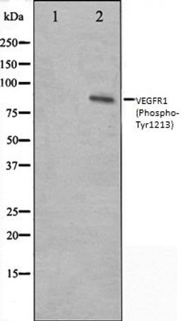 Western blot analysis of HeLa whole cell lysates using VEGFR1 (Phospho-Tyr1213) antibody, The lane on the left is treated with the antigen-specific peptide.