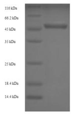 (Tris-Glycine gel) Discontinuous SDS-PAGE (reduced) with 5% enrichment gel and 15% separation gel.